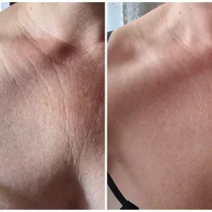 KRX Aesthetics Neck Cream Крем-лифтинг для шеи " Подтяжка шеи"